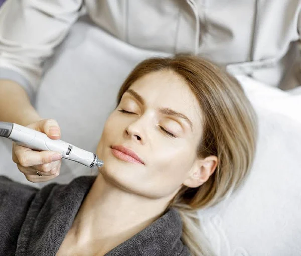 Especialización de Peeling Facial